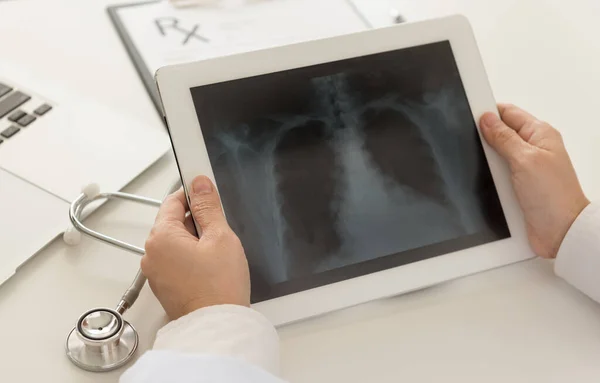 Doctor Examining Ray Lung Radiography Tablet Computer Hospital — Stock Photo, Image