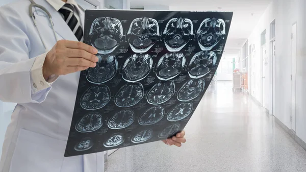 Doktor, hasta odasındaki hastanın beyin tomografisi ile beyin röntgenlerini kontrol et..