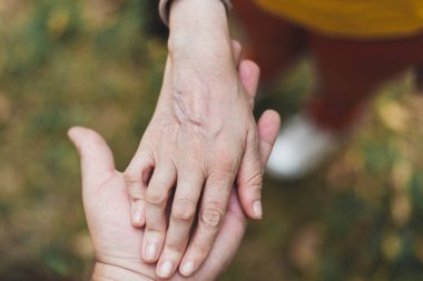 Açık havada eklem iltihabı olan birine yardım eden güçlü bir adamın yakın çekimi. Fiziksel engelli birine yardım ederken erkeğin gösterdiği nazik ve sevecen bir davranış.