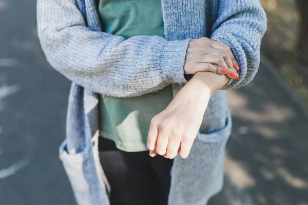Frau Überprüft Haut Aufgrund Von Reizungen Mädchen Untersucht Ihre Hand — Stockfoto