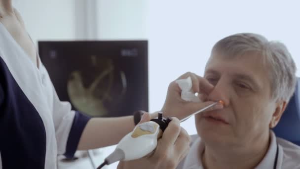 医師は 耳鼻咽喉科の望遠鏡で患者の鼻を調べるし モニターの画面を見ています 年配の男性がモダンなクリニックの耳鼻科で鼻をチェックします — ストック動画