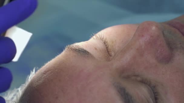 Lékař udělat makro fotografii na telefonu zkoumat kůži pacienta melanomu — Stock video