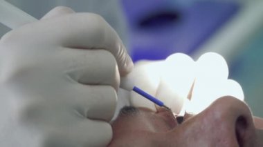 Dermatolog mol yanan adam göz kapağı üzerinde lazer ile