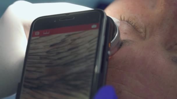 Kosmetikerin macht Makro-Foto vom Maulwurf der Patientin am Telefon — Stockvideo