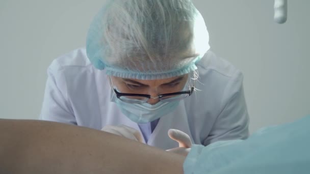 Dermatolog, spalanie pieprzyk na skórze pacjenta — Wideo stockowe