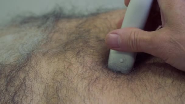 Arzt untersucht Bauch von erwachsenem Mann mit Ultraschallgerät — Stockvideo