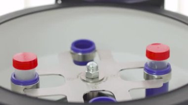 Doktor iki kat plazmaferez sonra bölünmüş kan ile bir tüp almak