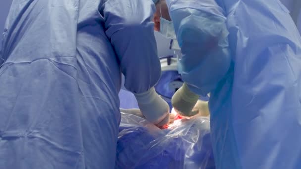 Surgeons make operation — Stock Video