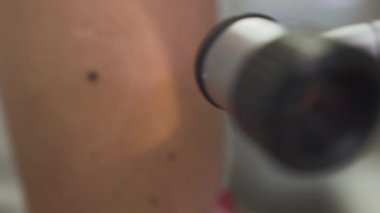 Dermatoscope iş başında