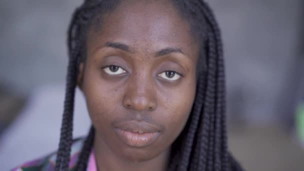 Close-up of young African American woman with problem skin looking at camera. Skincare concept. — Stock Video