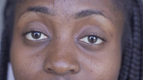 Extreme Nahaufnahme einer jungen afrikanisch-amerikanischen Frau mit Problemhaut, die in die Kamera blickt. Hautpflegekonzept. — Stockvideo