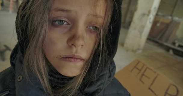 Nahaufnahme eines erschöpften syrischen Flüchtlings mit schmutzigem Gesicht, der einschläft. Müdes Kind mit schönen grauen Augen auf der Straße erstarrt. — Stockvideo