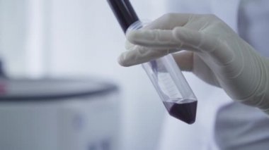 Hemşirelerin ellerinin şişeyi şırınga ve kapama numuneleriyle doldurduğu aşırı yakın çekim. Covid-19 salgınının laboratuarında çalışan üniformalı ve eldivenli tanınmayan doktor veya laboratuvar asistanı..