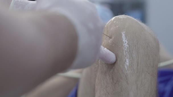 Extremo close-up do médico inserindo seringa no joelho masculino e usando equipamentos de ultra-som. Reumatologistas caucasianos a tratar o homem caucasiano no hospital. Medicina, exame . — Vídeo de Stock