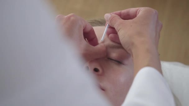 Extreme close-up van acupuncturist inbrengen naald in het gezicht van jonge vrouw. Blanke dokter die hoofdpijn behandelt van een blond Aziatisch uitziend meisje. Alternatieve geneeskunde, Chinese genezing therapie. — Stockvideo