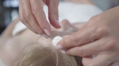 Tanımlanamayan doktor, kadın hastanın kafa derisinden iğne alıyor. Sarışın, beyaz bir kadının akupunktur kliniğinde yatan yakın çekimi. İyileşme, tedavi, alternatif tıp.