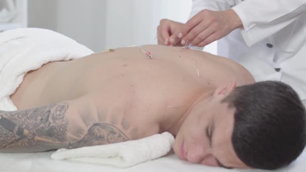 Acupuncteur méconnaissable débranchant l'électricité des aiguilles. Brunette jeune homme caucasien allongé sur le canapé comme femme médecin guérir ses maux de dos avec acupuncture. — Video