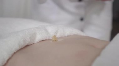 Doktor kadın karnında moxa yakıyor. Profesyonel Kafkasyalı akupunkturcu karın ağrısı ya da tanınmayan genç bir kadının jinekolojik sorunları. Direkt moxibustion, akupunktur.