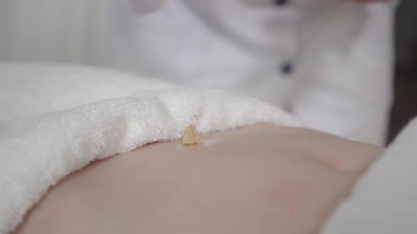 Dottore che illumina Moxa sulla pancia femminile. Agopuntore caucasico professionista che guarisce mal di stomaco o problemi ginecologici di una giovane donna irriconoscibile. Moxibustione diretta, agopuntura. — Video Stock