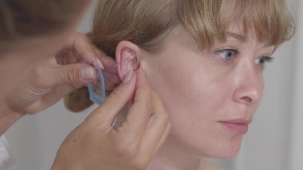 Close-up gezicht van jonge vrouw met wazig arts inbrengen van naalden in haar oor. Zijaanzicht portret van blond mooi blank meisje op acupunctuur procedure. Alternatieve geneeskunde, stressbehandeling. — Stockvideo