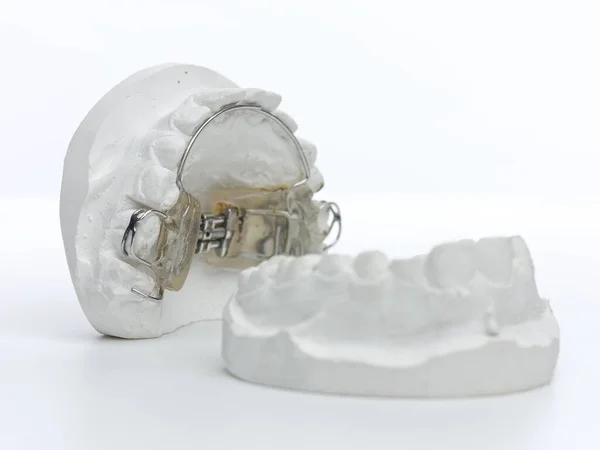 Molde Dental Gris Dientes Prótesis Corsé Dental Modelo Encías Humanas — Foto de Stock