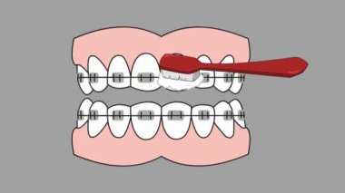 Diş Bakımı - vektör animasyon