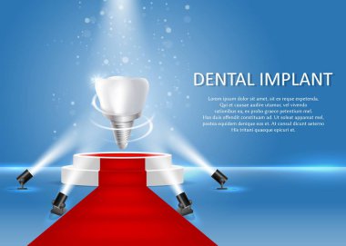 Dental implant vektör poster veya başlık sayfası şablonu