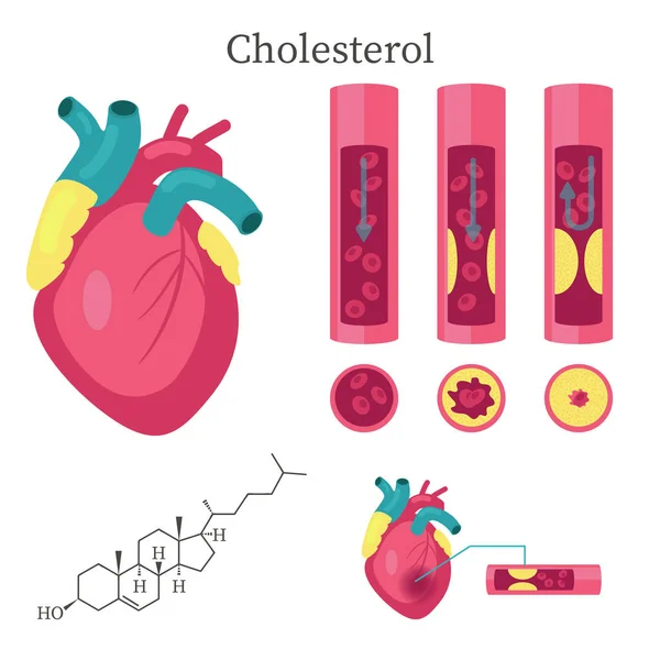 Cholesterol ilustracja na białym tle projekt płaski wektor — Wektor stockowy