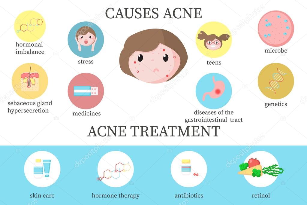 Acne causes and treatment diagram, vector flat illustration