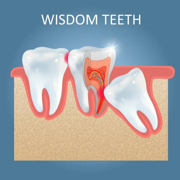 Wisdom teeth problems vector poster design template