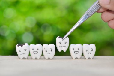 Diş hekimi diş sağlığı konsepti için çürümüş diş modelini cımbızla kullanır