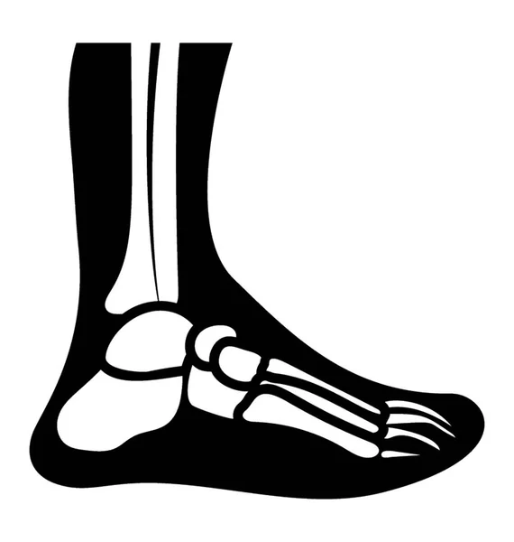 Ankle Joint Solid Icon Design — Stock Vector