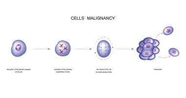 vector illustration of a process of malignancy cells clipart