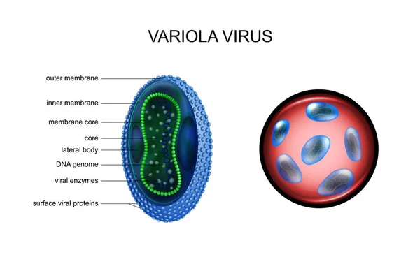 Ilustração Vetorial Varíola Varíola Vírus Infeções Especialmente Perigosas — Vetor de Stock