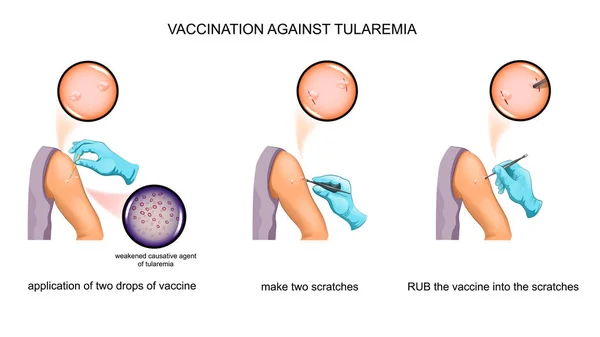 Vector Εικονογράφηση Της Διαδικασίας Εμβολιασμού Κατά Του Τουλαραιμία — Διανυσματικό Αρχείο