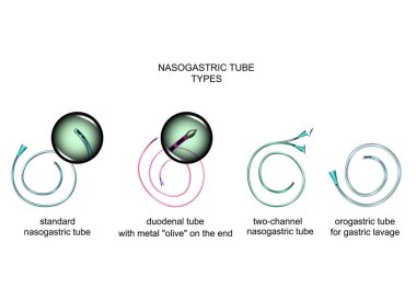 vector illustration of the types of nasogastric tubes clipart