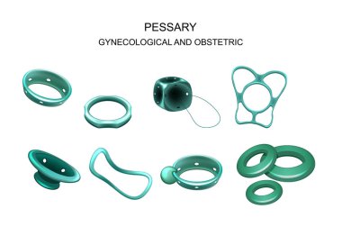 Jinekolojik ve obstetrik pessary