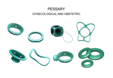 gynecological and obstetric pessary clipart