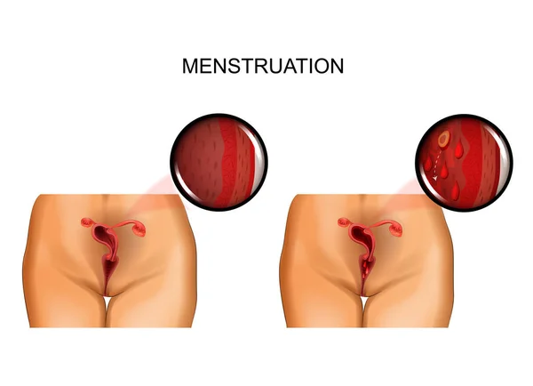 Órganos reproductores femeninos. menstruación — Vector de stock
