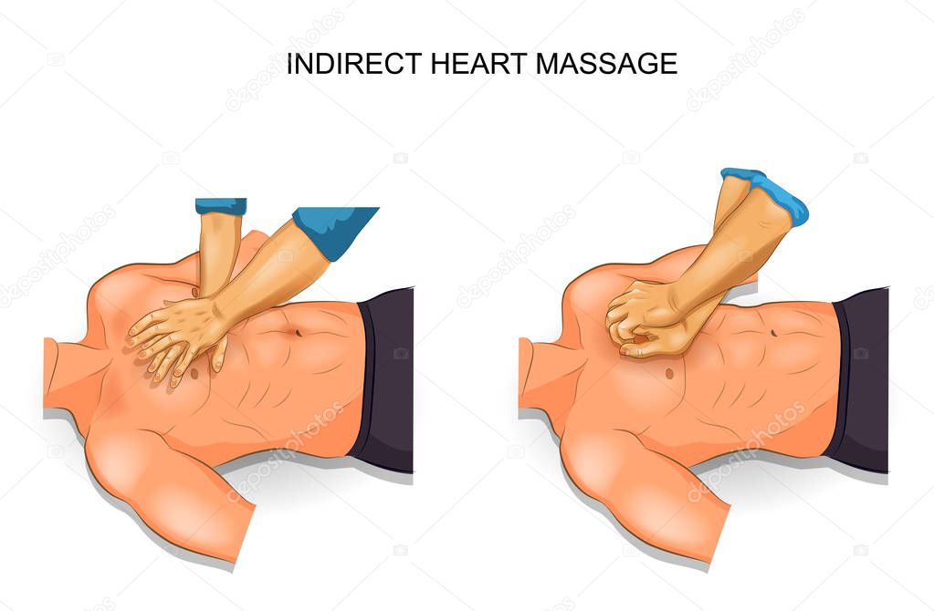 indirect heart massage options