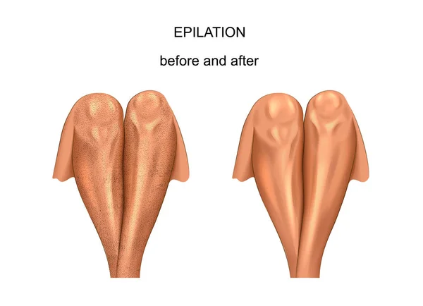 Piernas antes y después de la depilación — Vector de stock