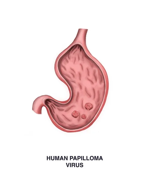 Ilustração Vírus Papiloma Humano — Fotografia de Stock