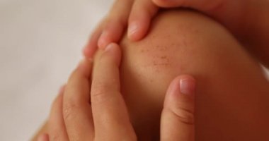 Çocuk diz çizik ile