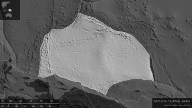 Caroline plaka şekli, bilek haritasının karanlık ve doyumsuz arka planında, bilgilendirici örtülerle çizilmiş. 3B görüntüleme