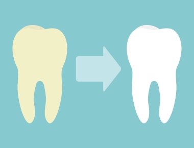 Diş beyazlatma kavramı vektörü