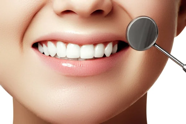 Догляд Красою Частина Жіночого Обличчя Ідеальна Посмішка Після Відбілювання Стоматологічний — стокове фото