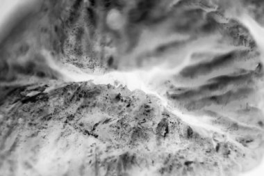 Kanser hücreleri mikroskop altında. Mikroskop altında kanser hücrelerinden etkilenen doku, Bilim. Kanser ilaçları. Kimya ve biyoloji.