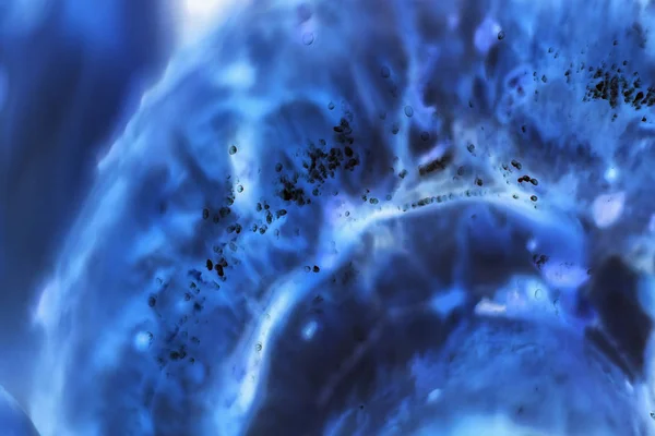 Rakovinné Buňky Pod Mikroskopem Tkáně Postižené Nádorovými Buňkami Pod Mikroskopem — Stock fotografie