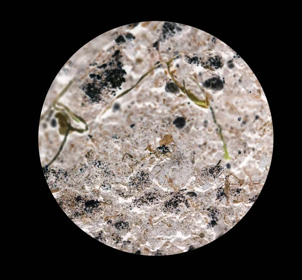Batteri o cellule al microscopio. Moltiplicazione dei batteri — Foto Stock