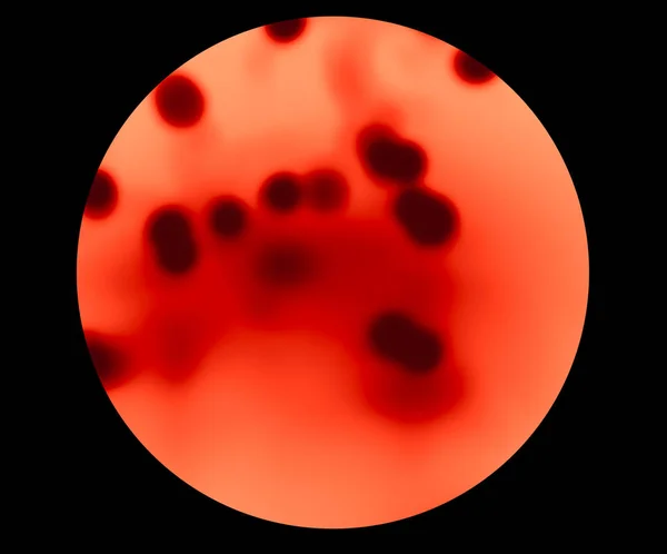 กล้องจุลทรรศน์ ประเภทเลือด — ภาพถ่ายสต็อก